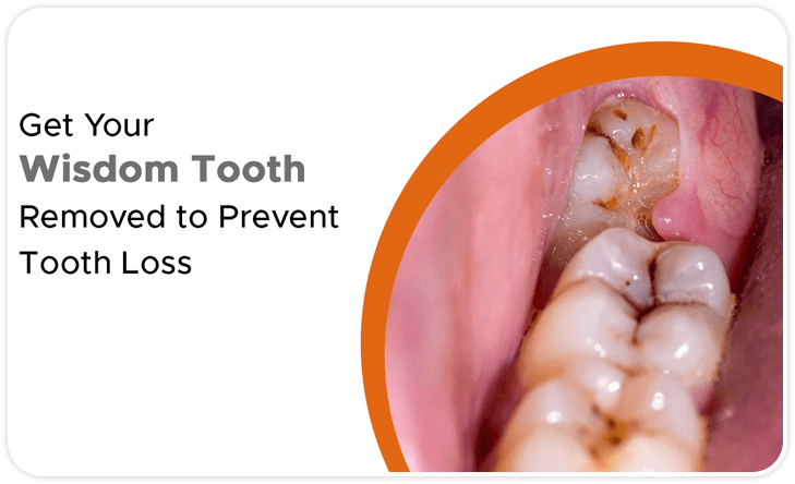 Dental Clip Treatment in Hyderabad