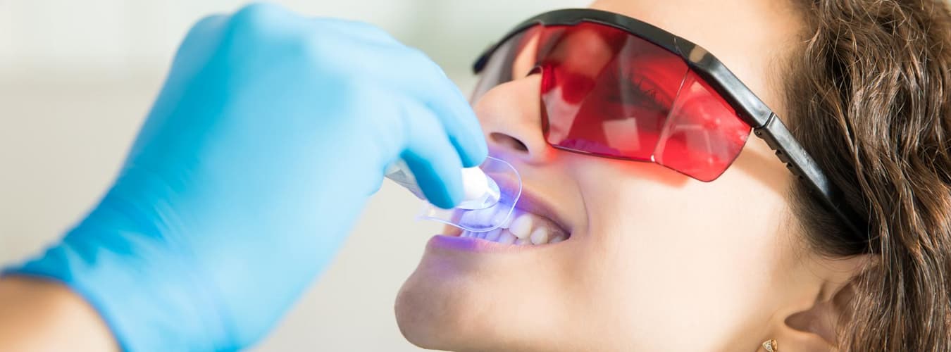 Teeth-whitening