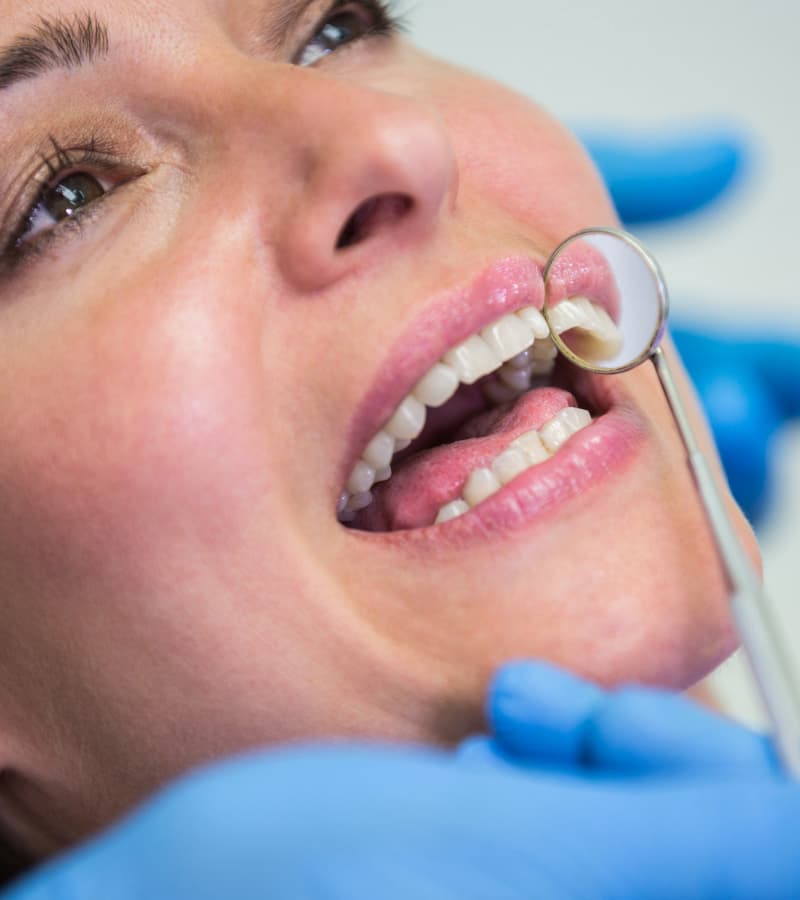 when-you-need-a-dental-crown-