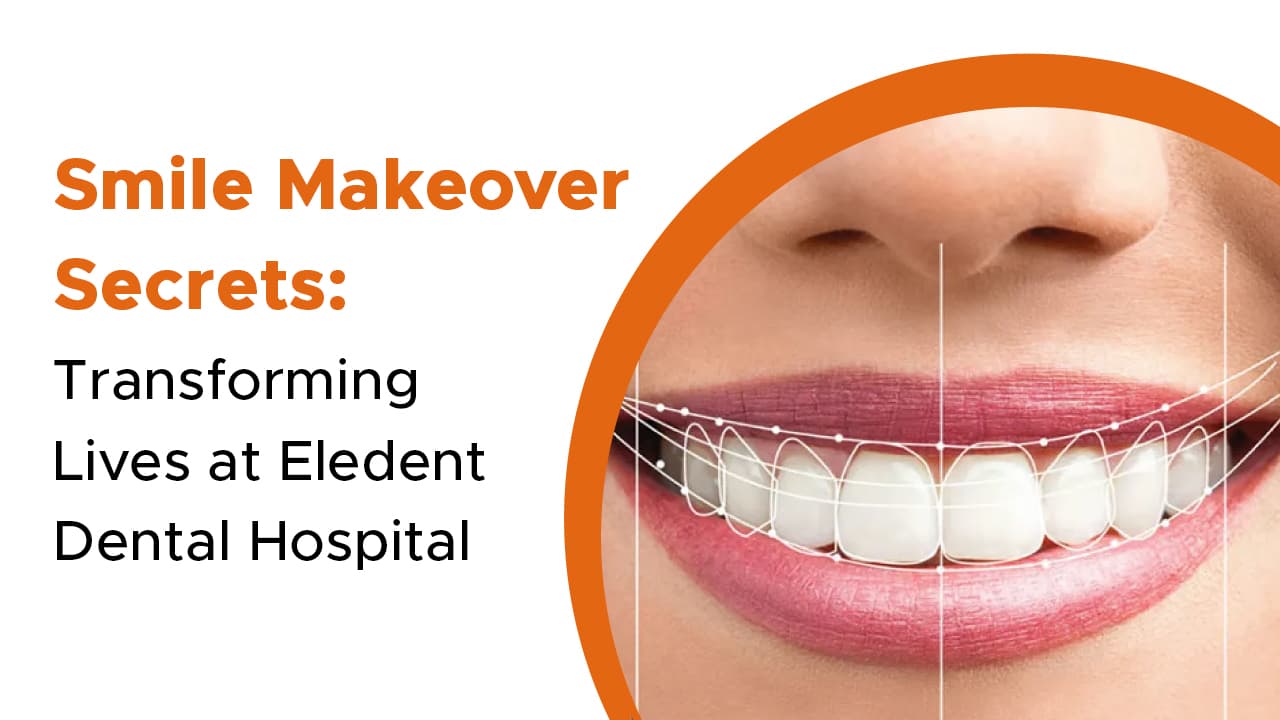 Smile Makeover Secrets Transforming Lives At Eledent Dental Hospital