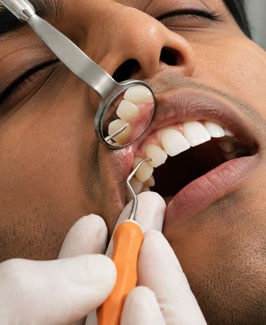 why-would-I-need-flap-surgery