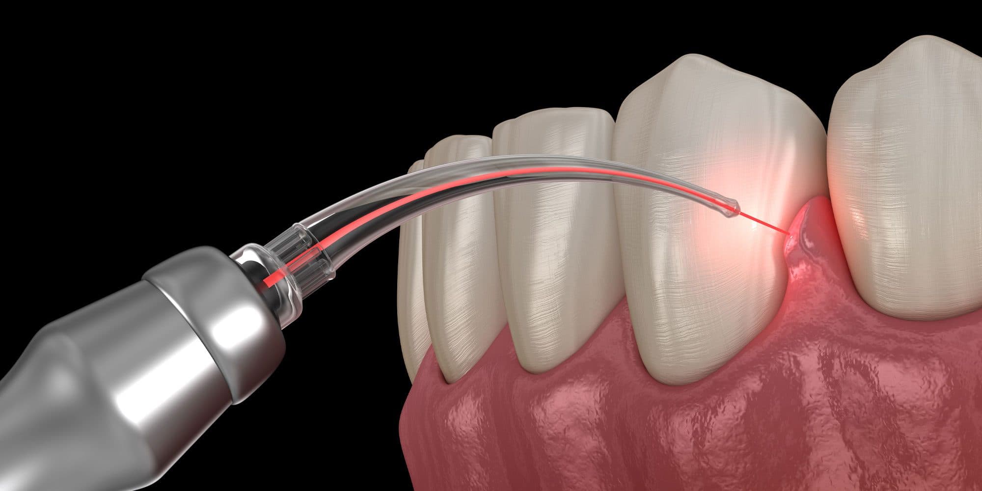 Treatment Advantages for Kukatpally Residents