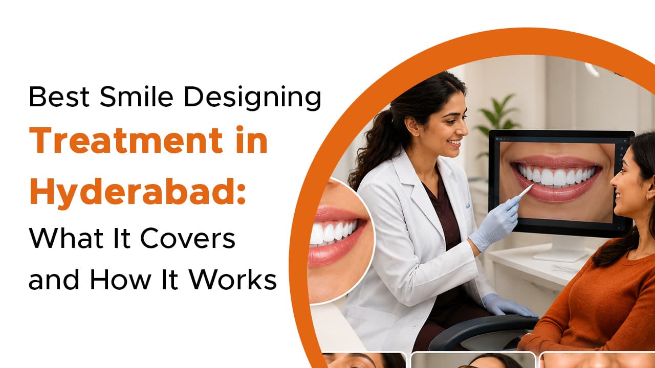 Best Smile Designing Treatment in Hyderabad: What It Covers and How It Works
