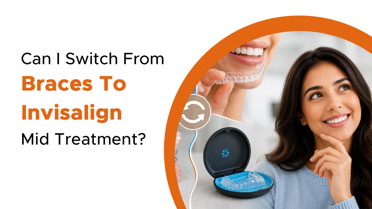 Can I Switch From Braces To Invisalign Mid Treatment?