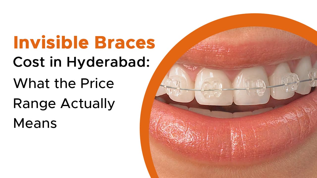 Invisible Braces Cost in Hyderabad: What the Price Range Actually Means