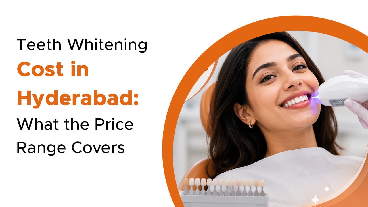 Teeth Whitening Cost in Hyderabad: What the Price Range Covers
