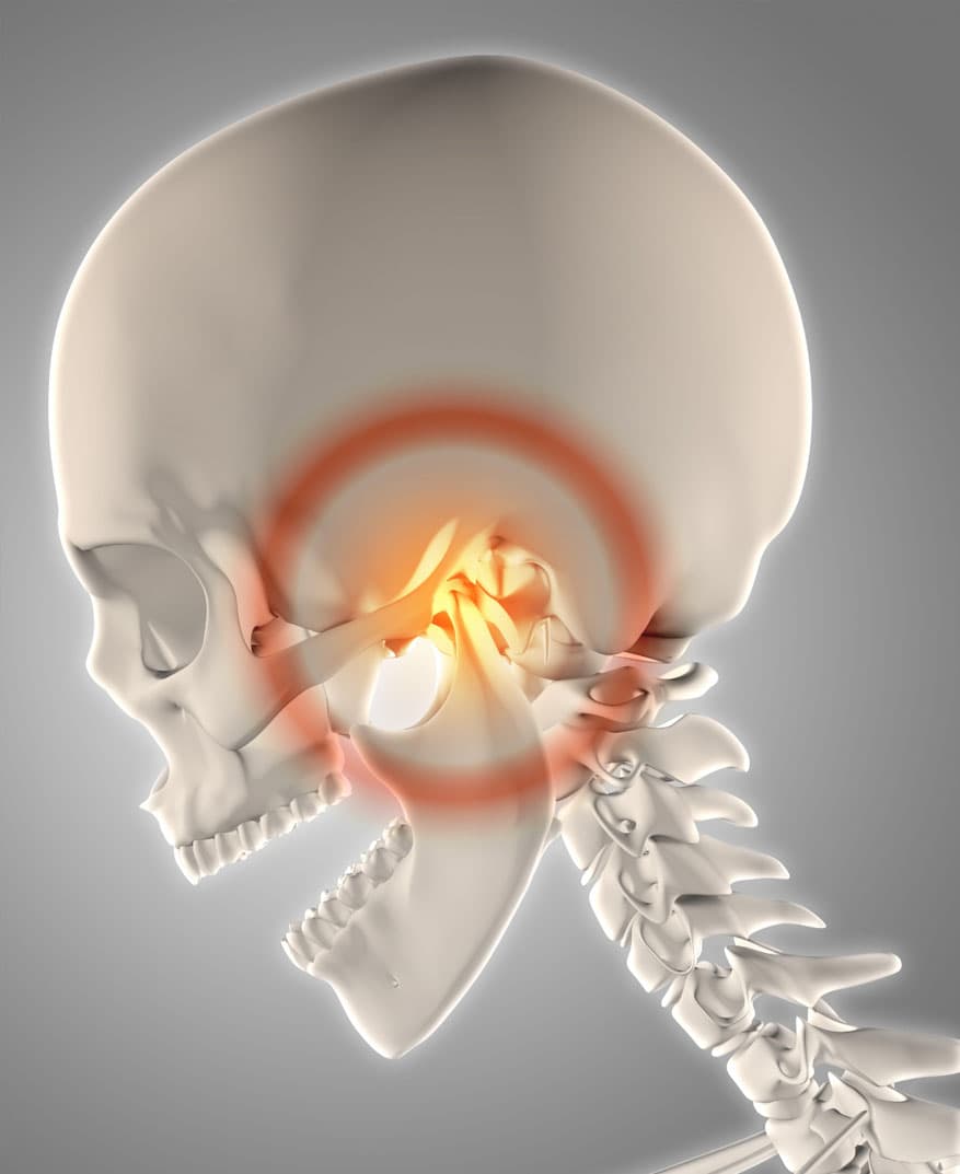 what-is-TMJ-disorder-and-why-treat-it