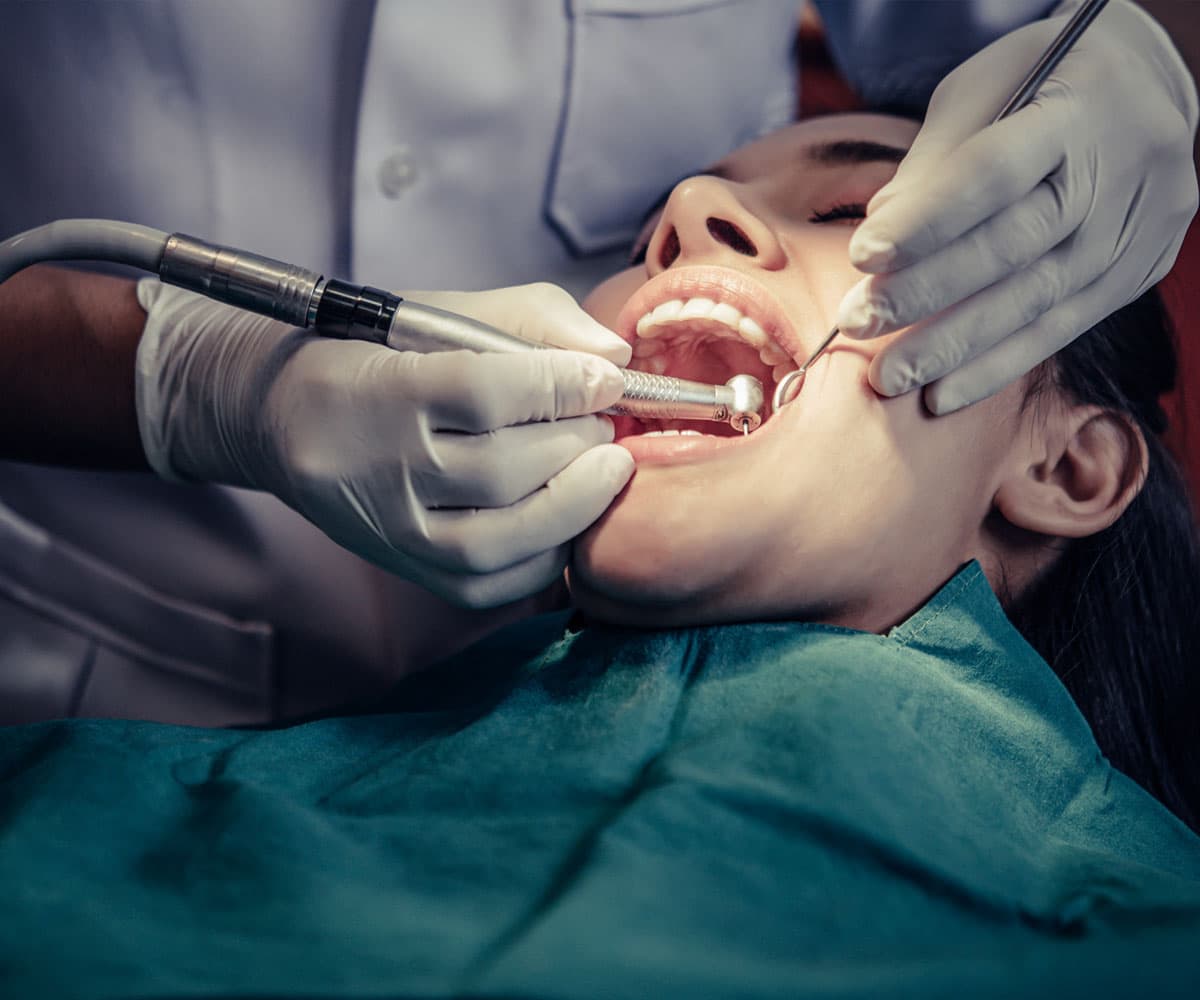 why-choose-eledent-dental-for-dental-fluorosis-treatment