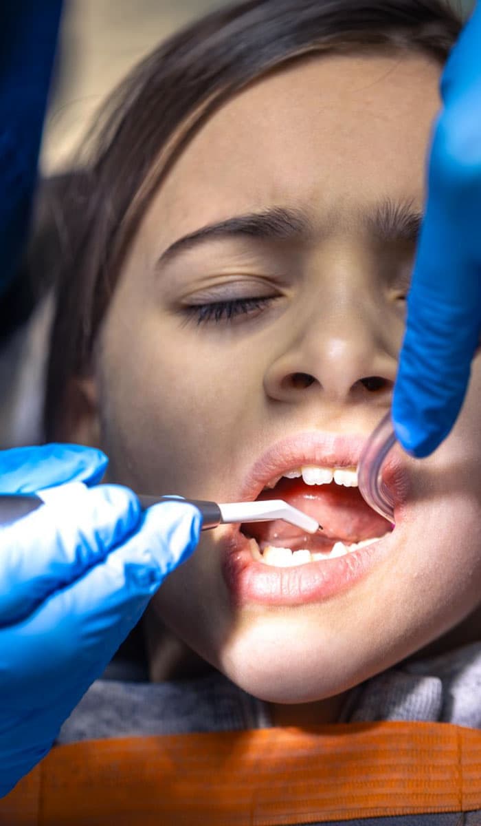 why-choose-eledent-for-dental-fluorosis