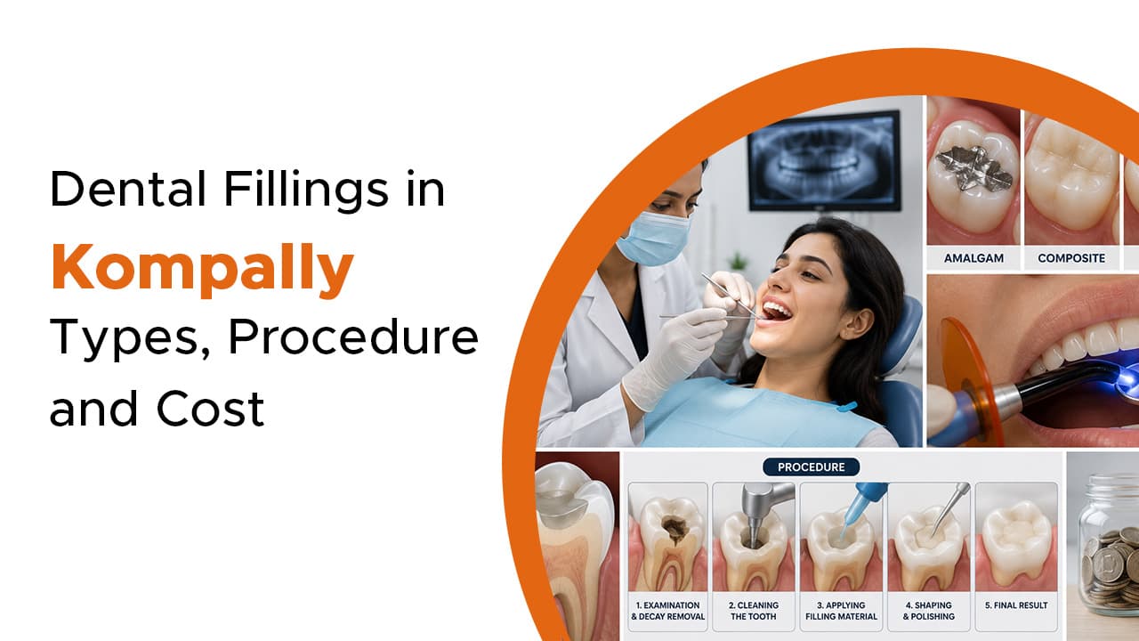 Dental Fillings in Kompally : Types, Procedure and Cost