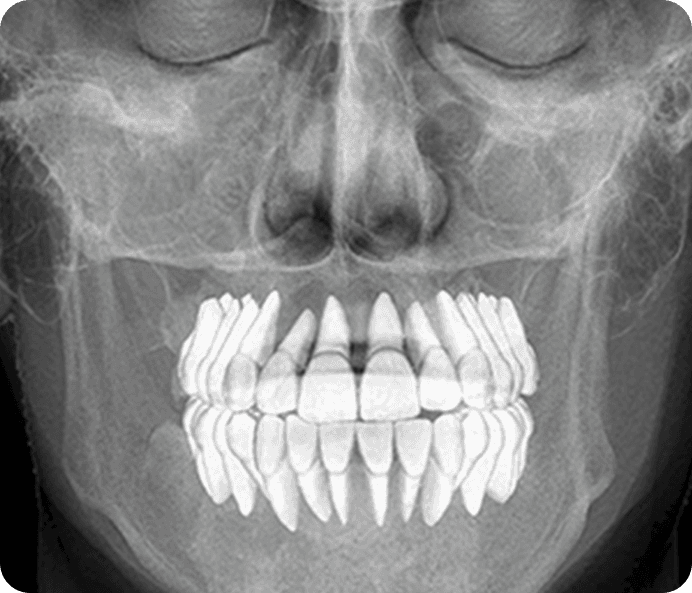 Digital smile designing technology