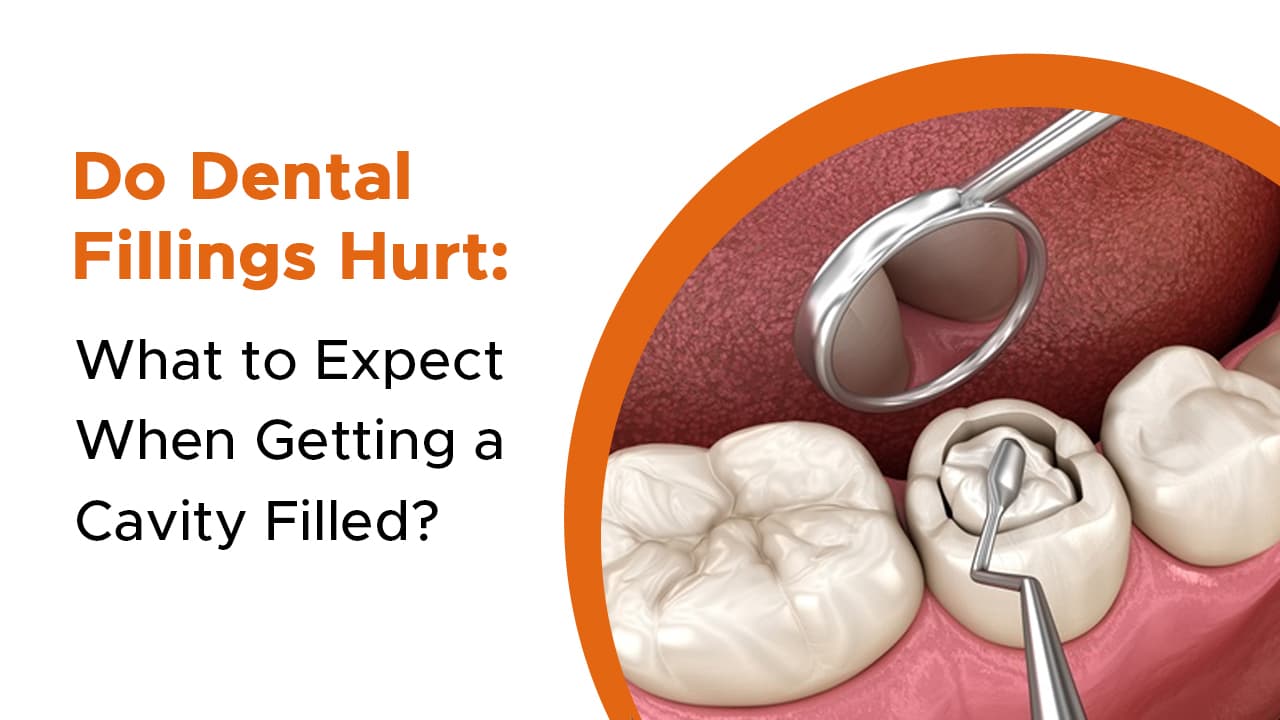 Do Dental Fillings Hurt: What to Expect When Getting a Cavity Filled?
