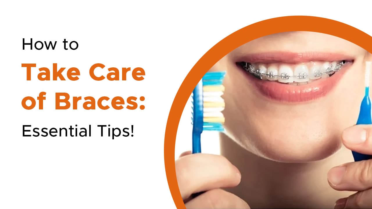 How to Take Care of Braces: Essential Tips!