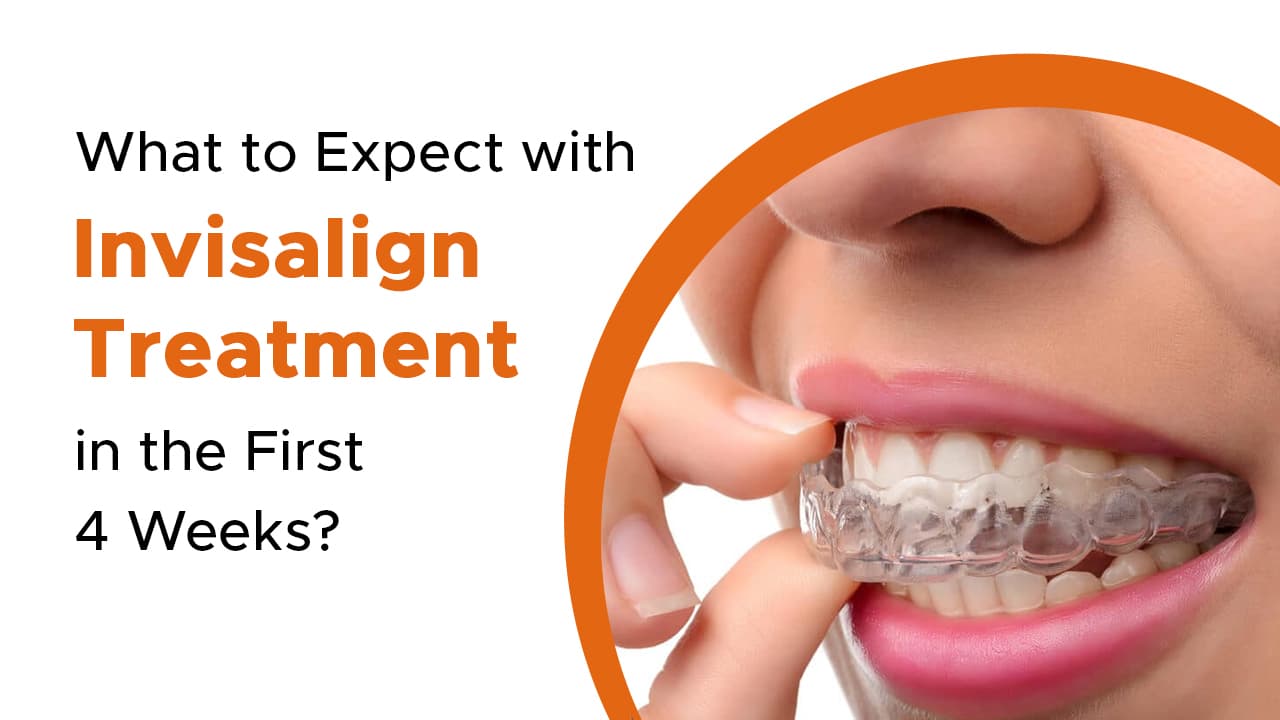 What to Expect with Invisalign Treatment in the First 4 Weeks?