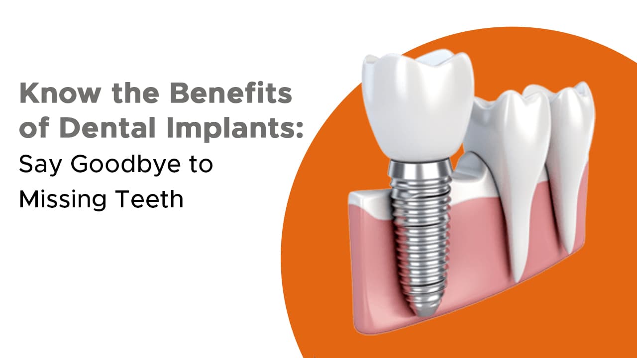 Know The Benefits Of Dental Implants Say Goodbye To Missing Teeth